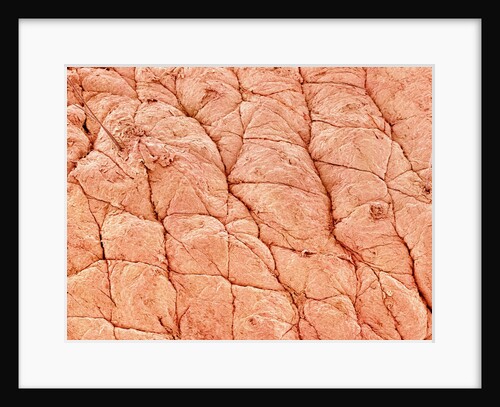 Human Skin by Anonymous