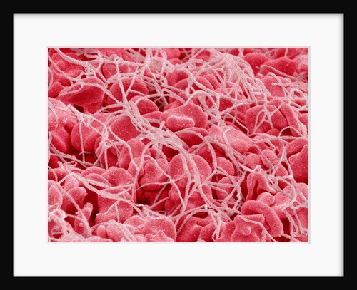 Coagulated Human Red Blood Cells by Anonymous
