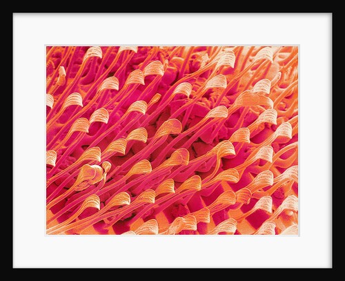 Tip of Leg of a Flower Fly by Anonymous