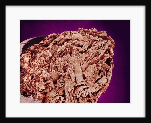 Burned Tip of Cigarette by Anonymous