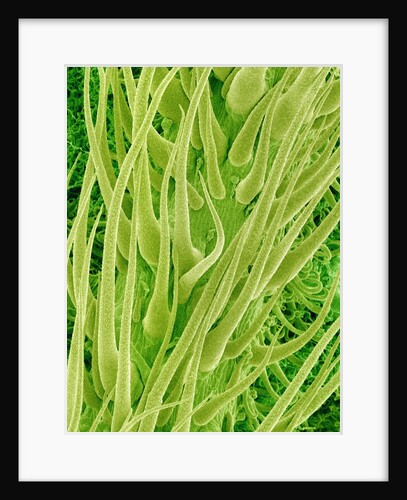 Underside of a Stinging Nettle Leaf by Anonymous
