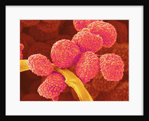 Moss Spores by Anonymous