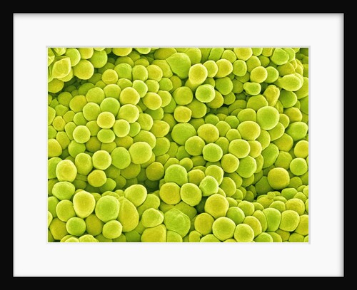 Pistil of Buttercup by Anonymous