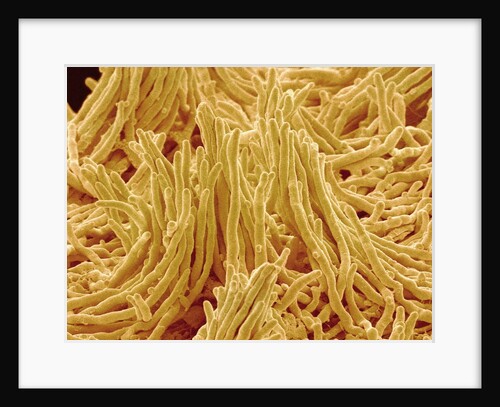 Mycelium of Mushroom by Anonymous