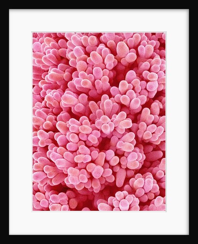 Pistil of Epiphyllum Cactus by Anonymous