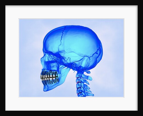 Human Skull by Anonymous