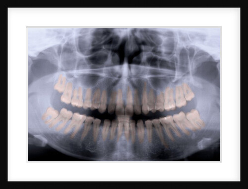 Panoramic X-Ray of Mouth by Anonymous