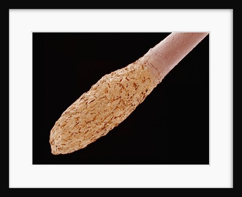 Human Hair Root by Anonymous