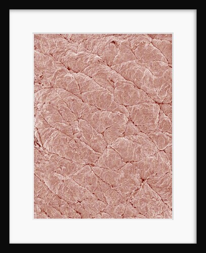 Human Skin by Anonymous