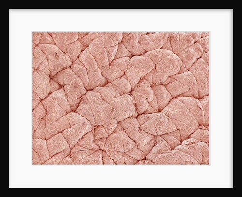 Human Skin by Anonymous