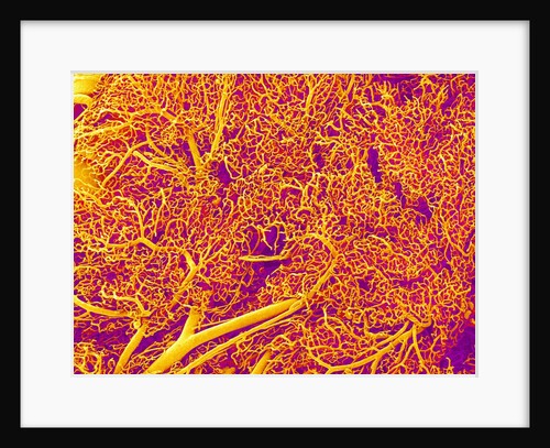Blood Vessel Cast from Rat Pancreas by Anonymous