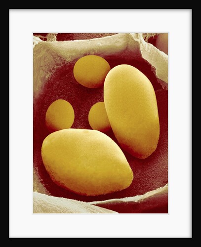 Starch Grains of Potato Cells by Anonymous