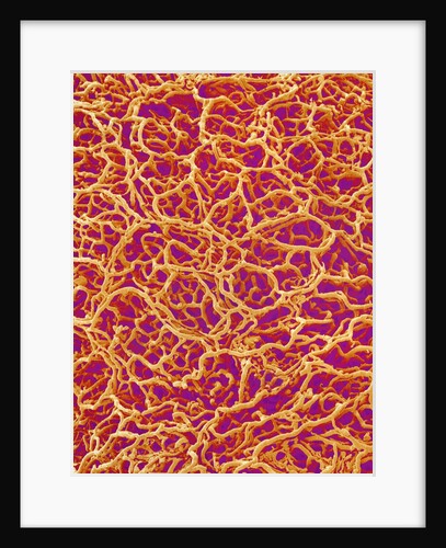 Blood Vessel Cast from Rat Colon by Anonymous