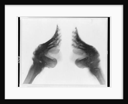 X-Ray of Bound Feet by Anonymous