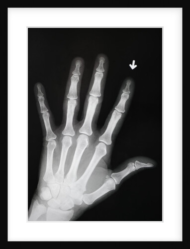 Hand Bones by Anonymous