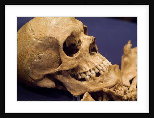 Skull of Early Settler by Anonymous