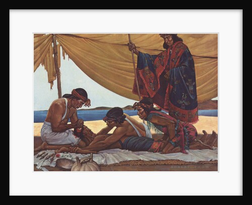 Trephining in Ancient Peru by Robert Thom