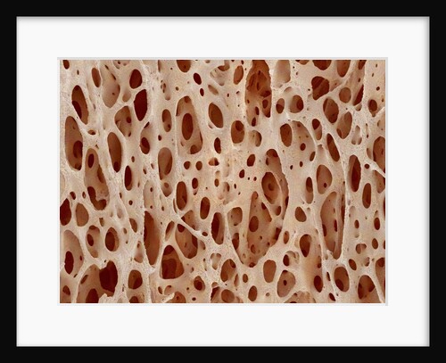 Bone tissue of a hen magnified x25 by Anonymous