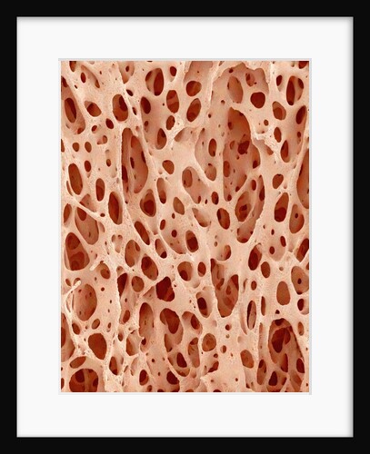 Bone tissue of a hen magnified x25 by Anonymous