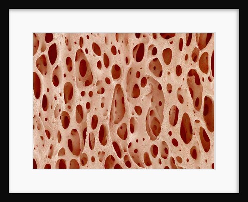 Bone tissue of a hen magnified x25 by Anonymous