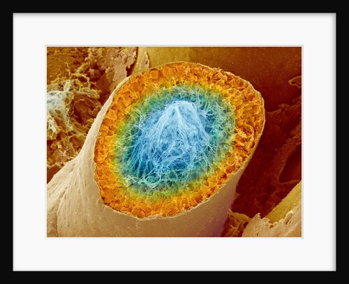 Sperm Production by Anonymous
