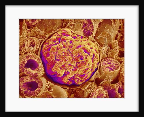 Glomerulus of kidney by Anonymous