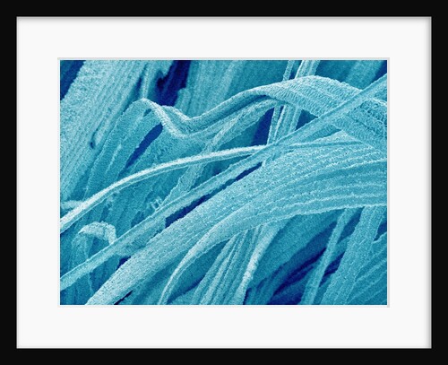 Lens fiber of a rabbit eye by Anonymous