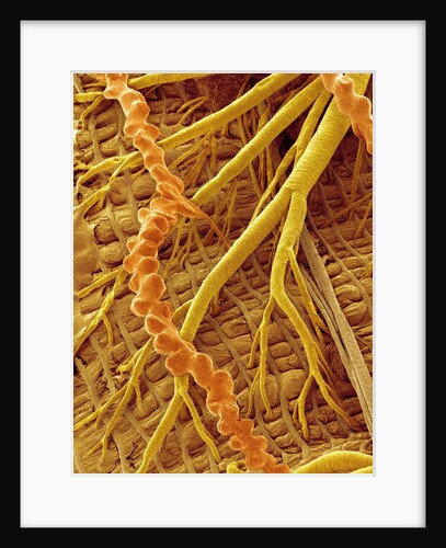 Interior of Moth larva by Anonymous