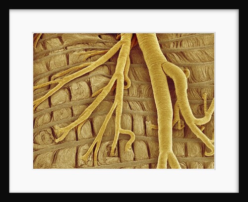 Interior of moth larva by Anonymous