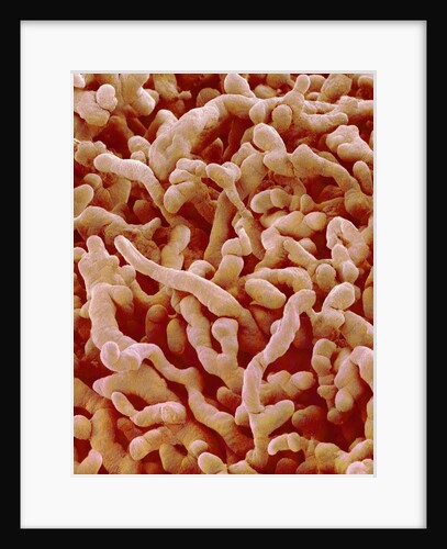 Human placenta by Anonymous