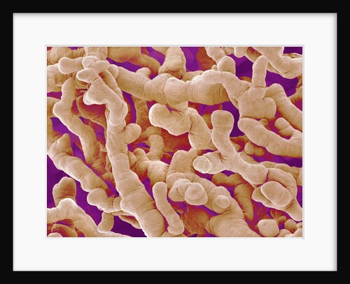 Human Placenta by Anonymous