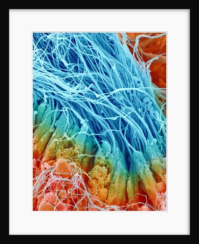 Sperm in rat testis by Anonymous