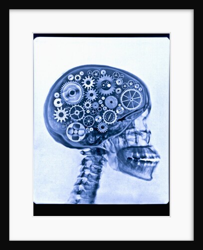 X-ray of skull with gears by Anonymous