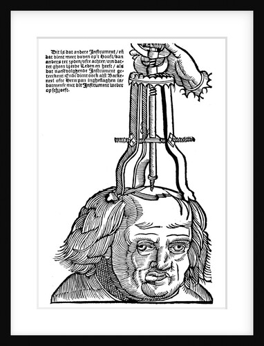Trepanation by Anonymous