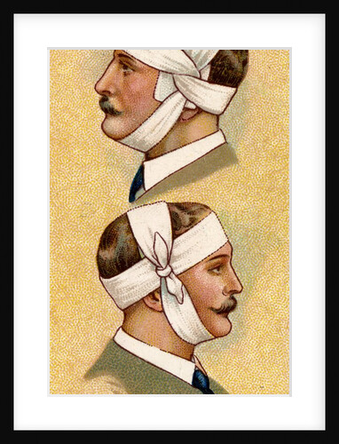 Man with bandaged head by Anonymous
