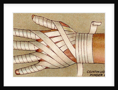 Bandaged hand by Anonymous