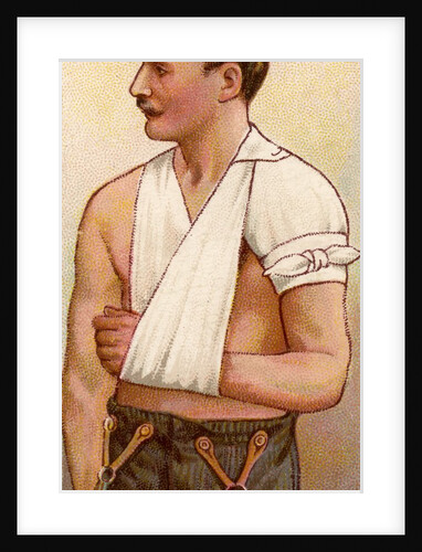 Man with sling and bandaged shoulder by Anonymous