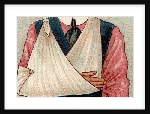 Arm in sling by Anonymous