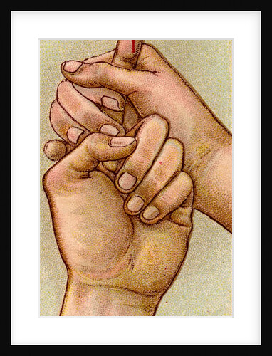 Bleeding finger by Anonymous