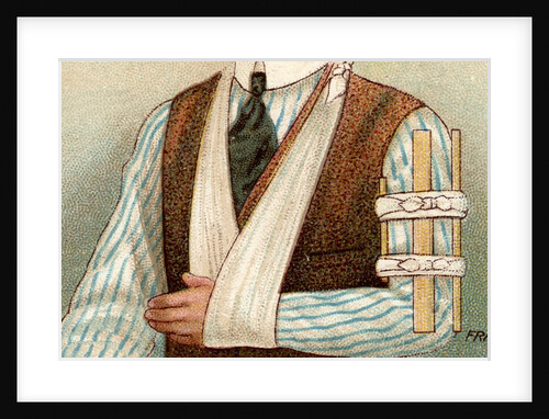 Man with sling and splint by Anonymous