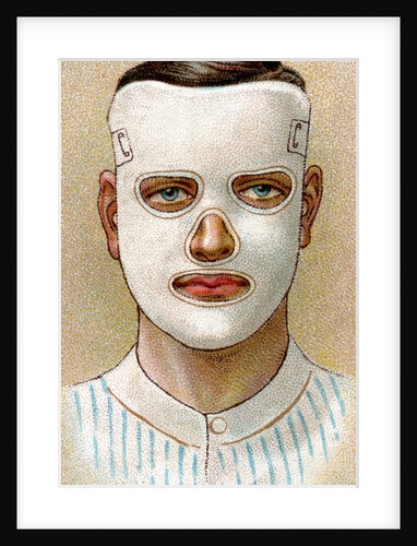 Mask for facial burns by Anonymous