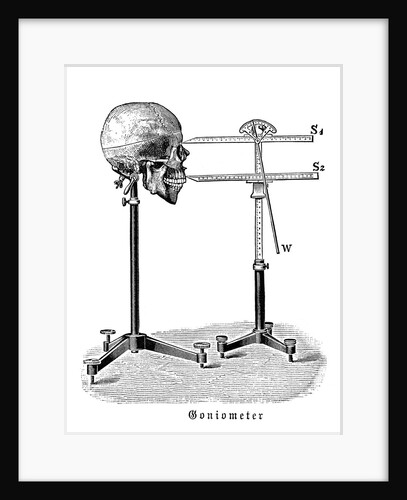 Goniometer measuring human skull by Anonymous