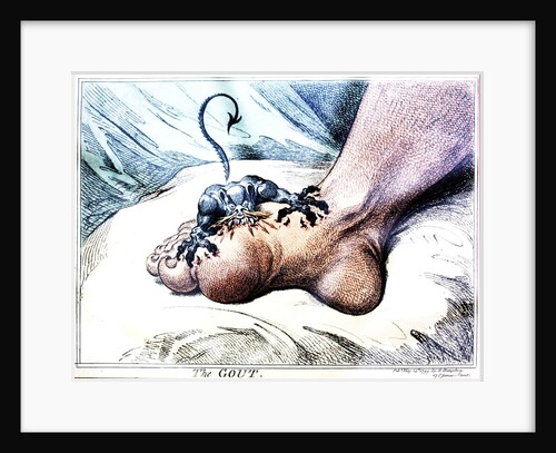 The Gout by Anonymous