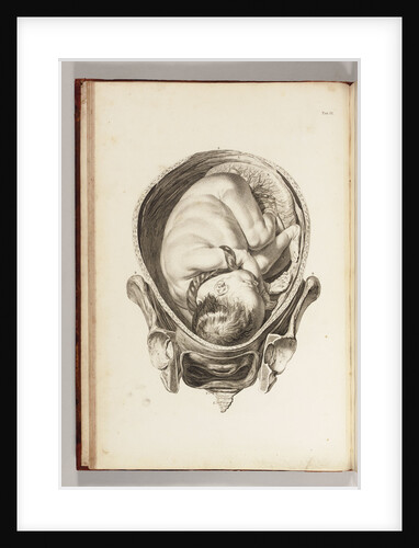 Engraving of a child in the womb by William Smellie