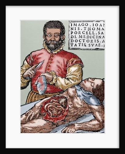 John Thomas Porcell (1528-ca.1580). Spanish doctor by Anonymous