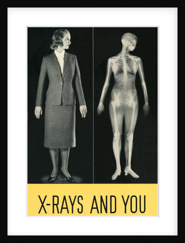 X-Rays and You by Anonymous