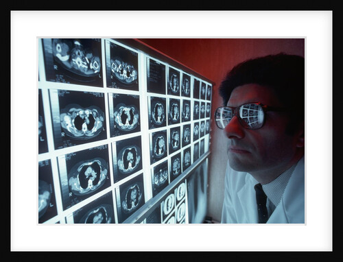 1980s doctor examining CAT scan by Anonymous
