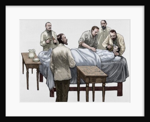 History of medicine. Chloroform anesthesia. Engraving, 19th century. Colored. by Anonymous