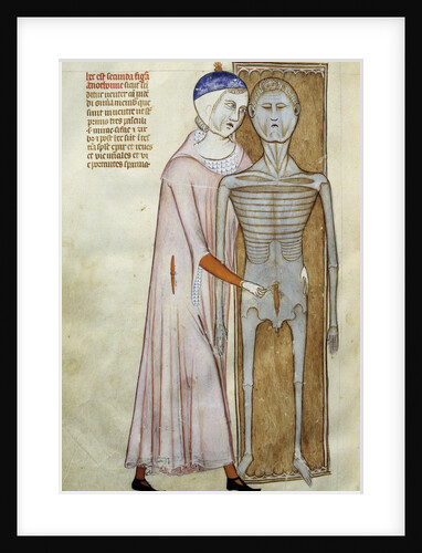 Board of anatomy and surgery depicting a dissection by Anonymous