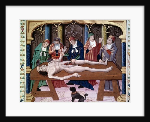 Autopsy, 15th century by Anonymous